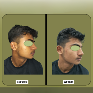 Before and after — face transformation