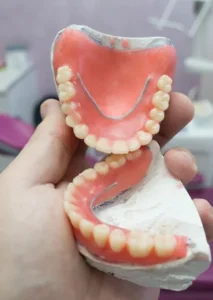 Best Removable Complete Denture treatment in Surat