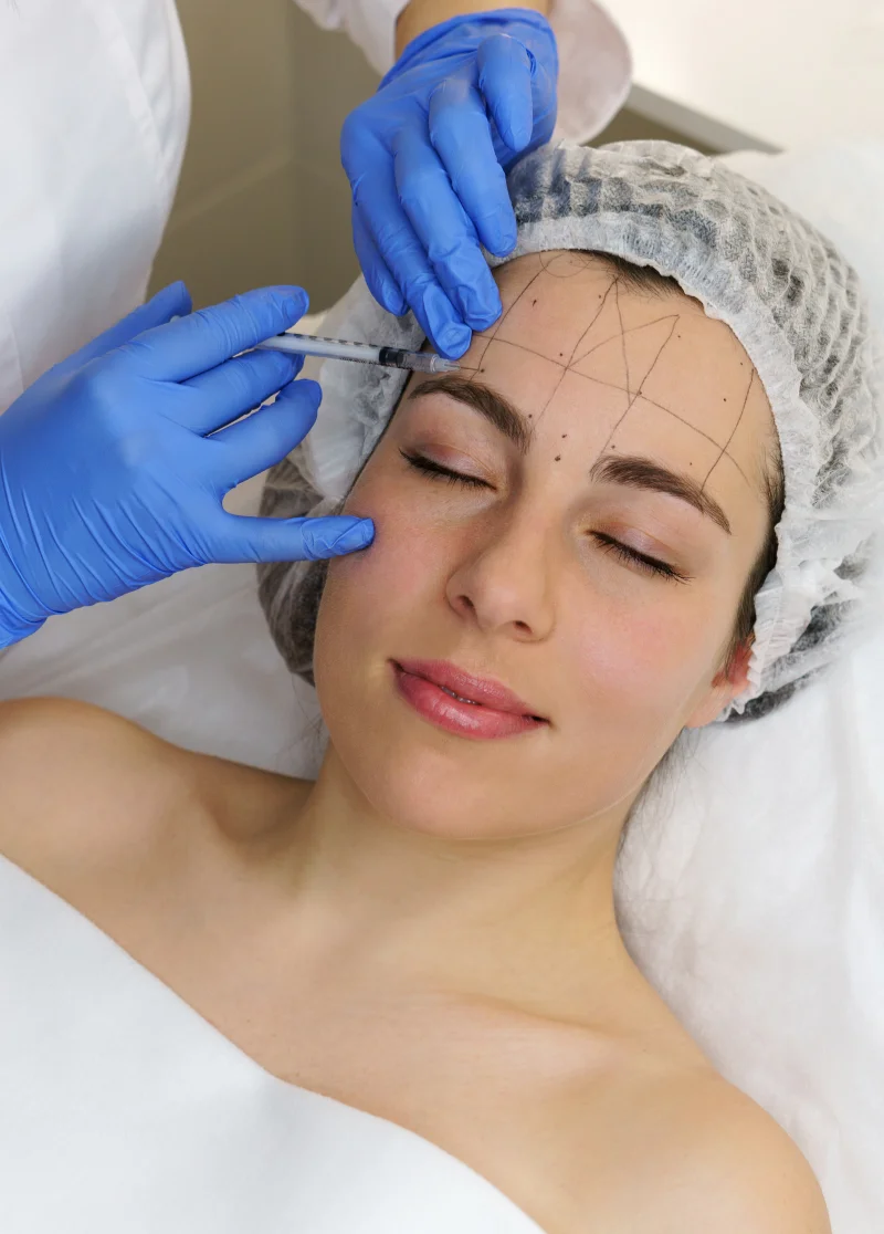 Botox filler
