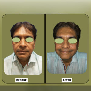 Before and after — beauty transformation