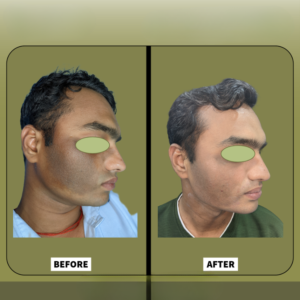 Before and after — cosmetic transformation