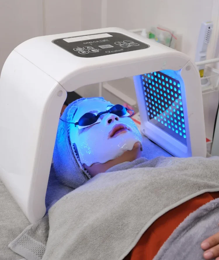laser treatment