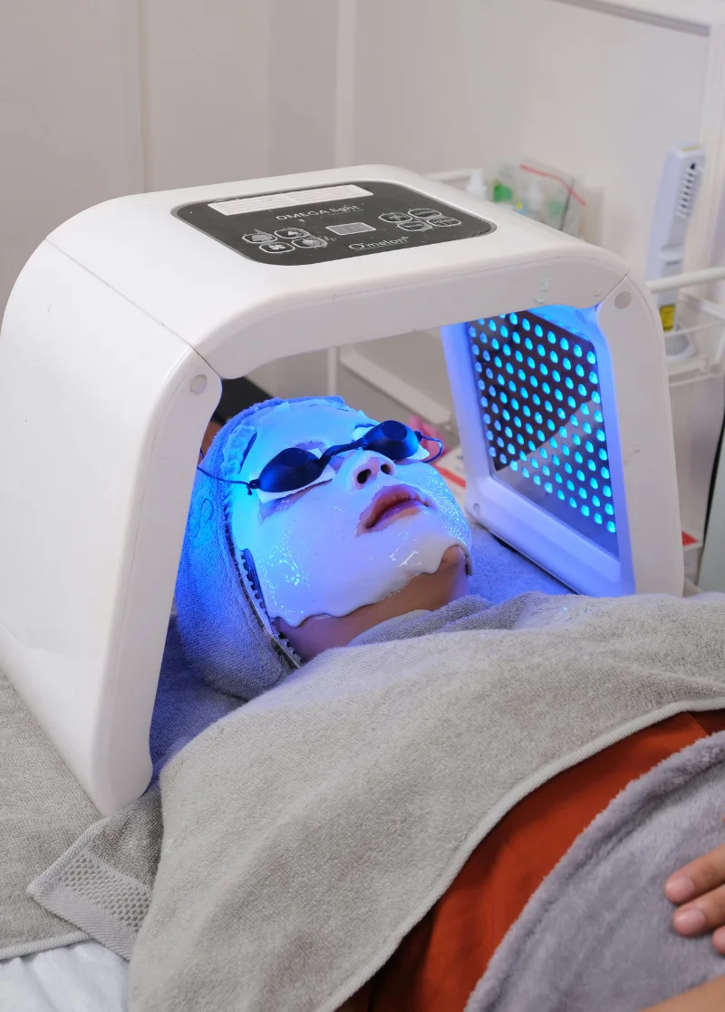 laser treatment