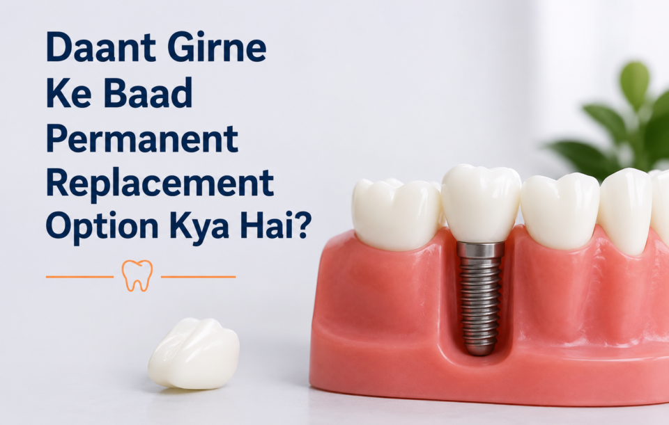 permanent daant replacement option