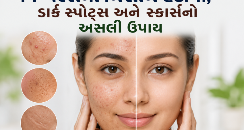 pimples na nishan hatavo