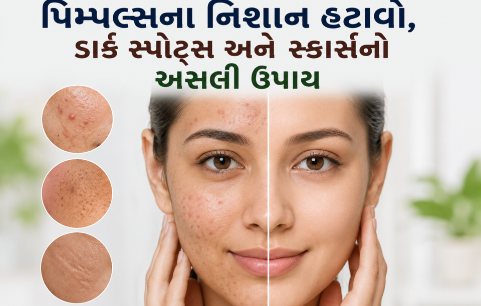 pimples na nishan hatavo