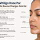 vitiligo ka side effect