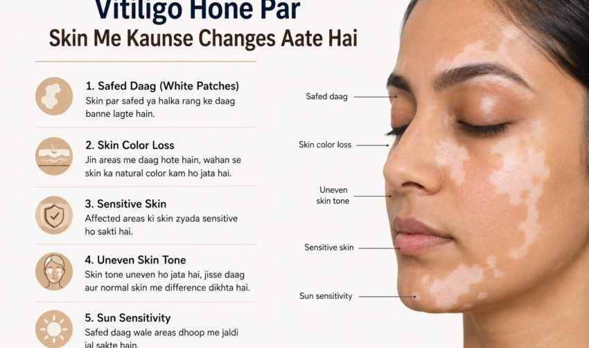 vitiligo ka side effect
