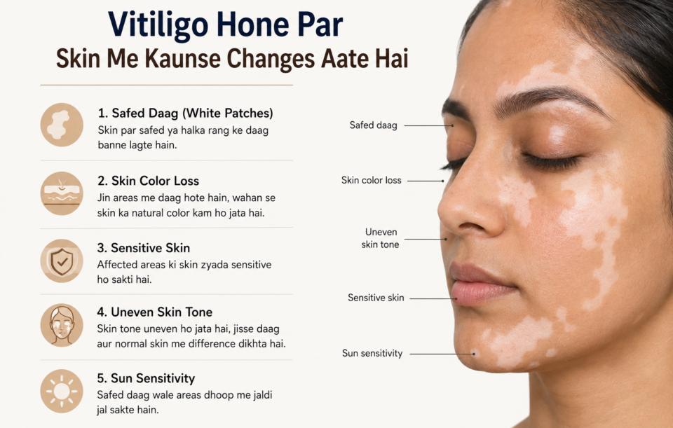 vitiligo ka side effect