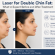 Laser for double chin fat