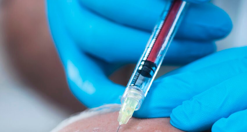 Best PRP Facial for Natural Skin Rejuvenation