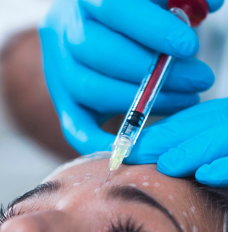 Best PRP Facial for Natural Skin Rejuvenation