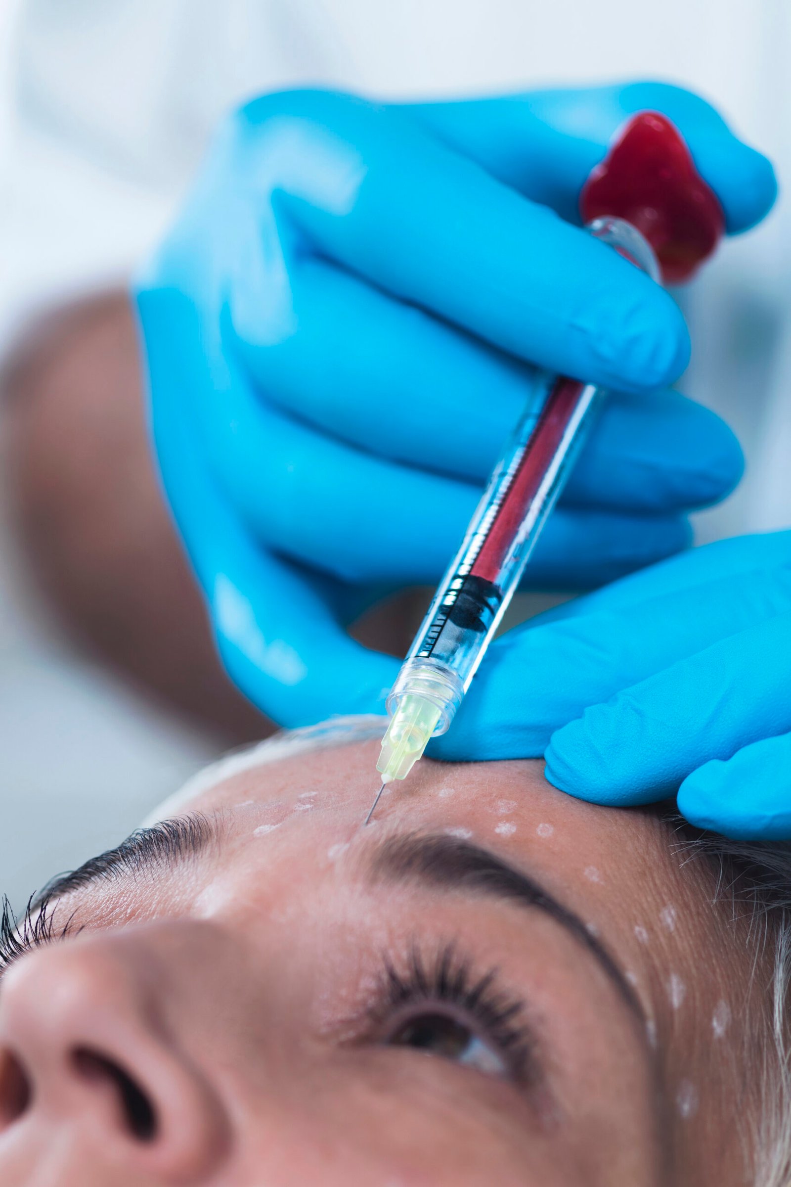 Best PRP Facial for Natural Skin Rejuvenation