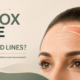 Botox for forehead lines