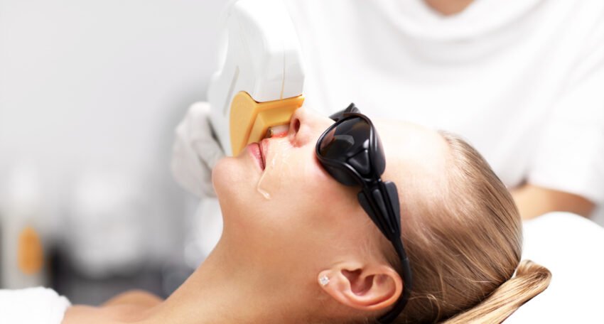 Laser Treatment for Tan Removal
