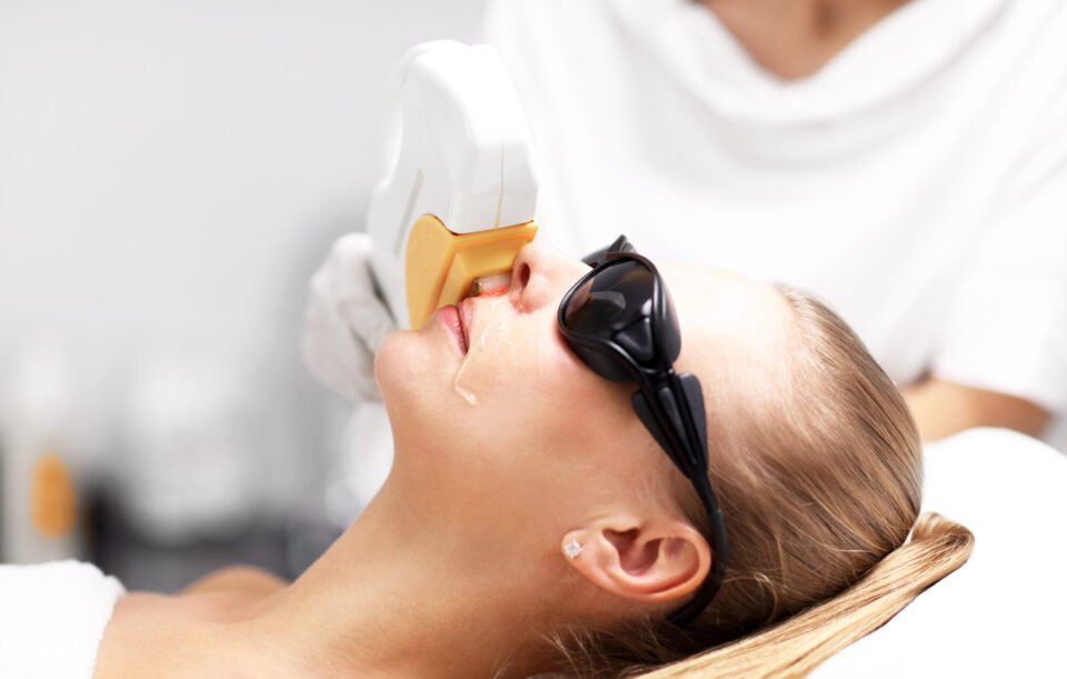 Laser Treatment for Tan Removal
