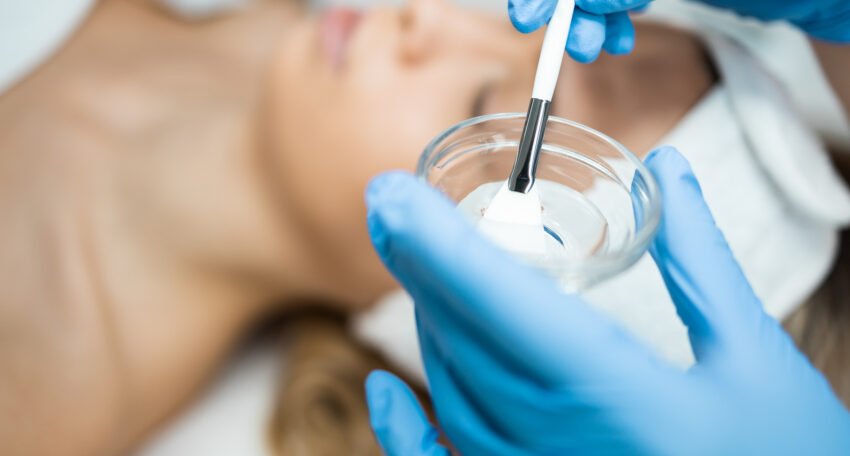 Chemical Peel off Treatment