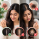 How Much Hair Fall Is Normal Treatment of hair fall in surat