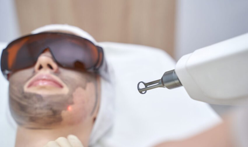 Laser Scar Treatment