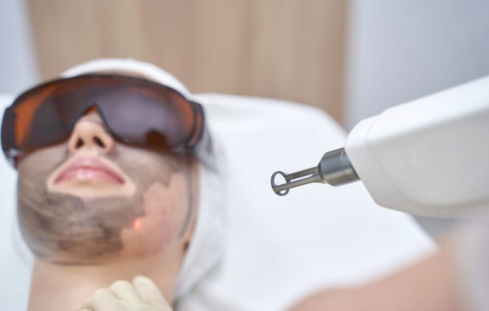 Laser Scar Treatment