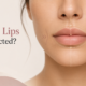 lip asymmetry correction